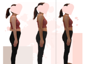 {{brizy_dc_image_alt entityId=