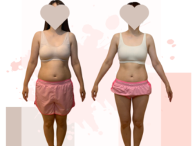 {{brizy_dc_image_alt entityId=